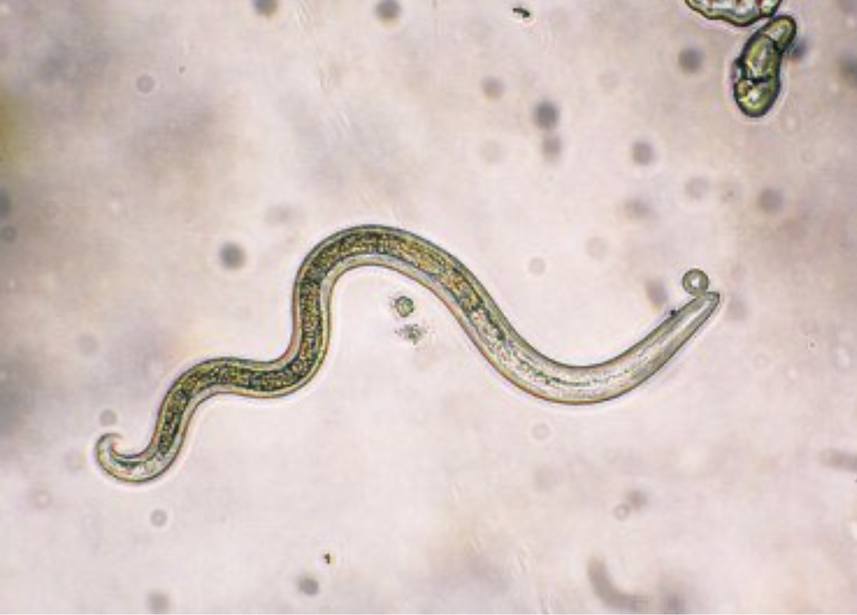 Understanding and Managing Parasitic Infections